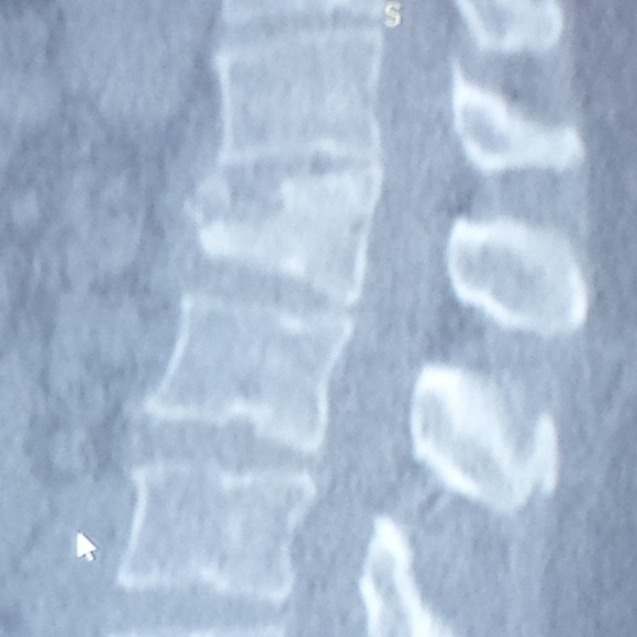 EVERYTHING - Picture 2 of 8